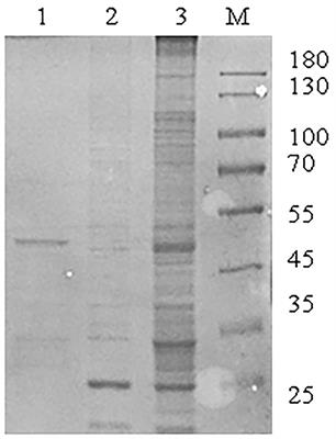 Analysis of Interaction Network Between Host Protein and M Protein of Swine Acute Diarrhea Syndrome Coronavirus